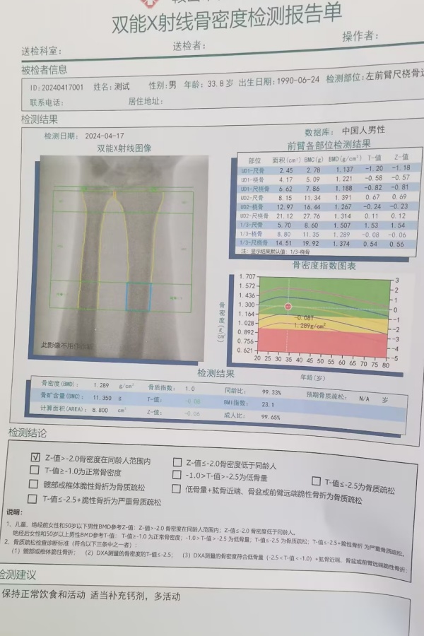 雙能X射線骨密度儀：準(zhǔn)確測(cè)量骨密度，助力骨質(zhì)疏松防治，守護(hù)骨骼健康